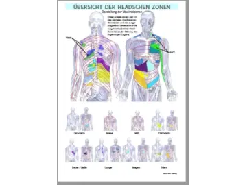 Übersicht Headsche Zonen